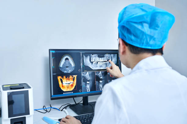 Best Emergency Tooth Extraction in Spotswood, NJ